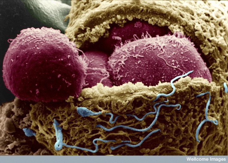 B0003392 Human embryo exposing the embryonic cells